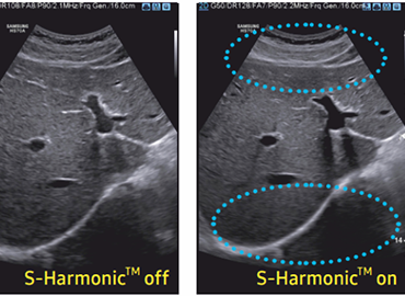S-Harmonic™ Technology